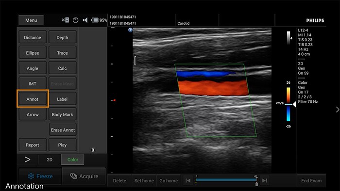 how to videos clinical image annotation