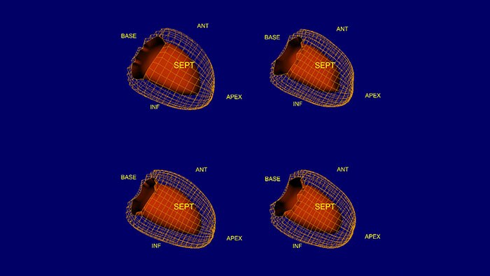 cedars sinai cardiac suite 2015 thumbnail