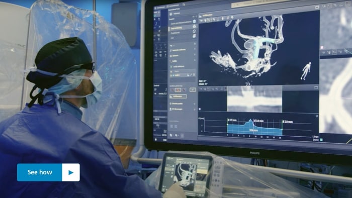Philips Neuro Azurion Smart CT