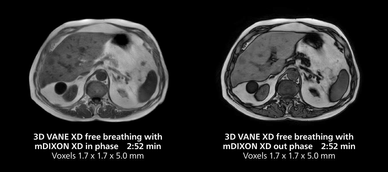 Knee mri two