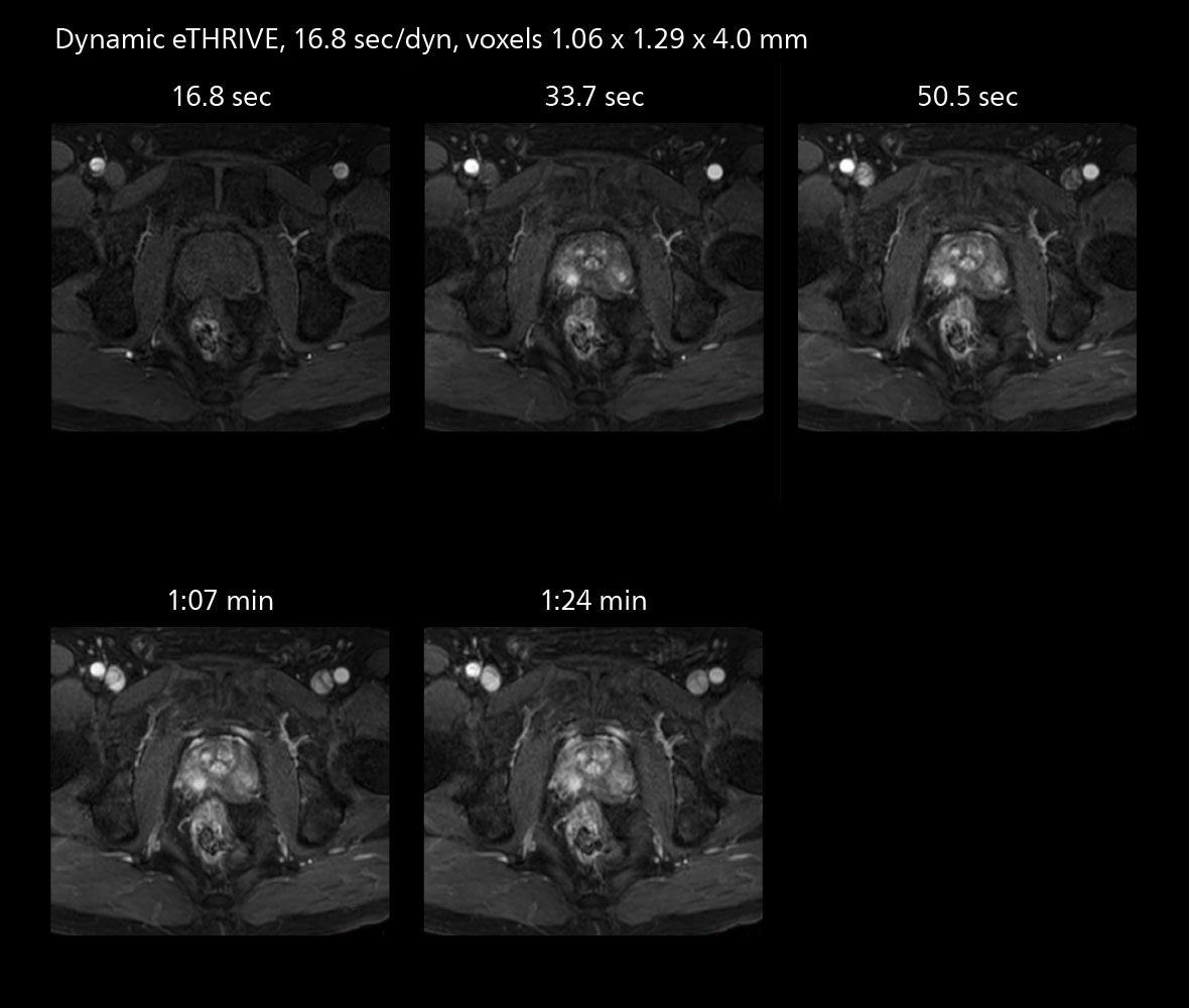 Prostate mri three