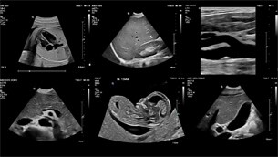 clinical results image