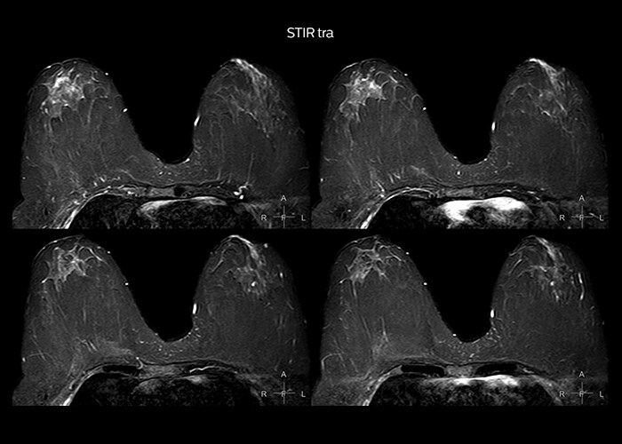 clinical cases tab3 image