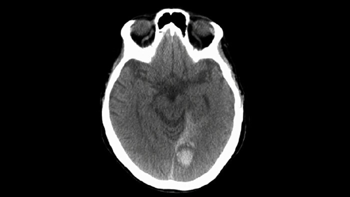 CBCT (CT-like)