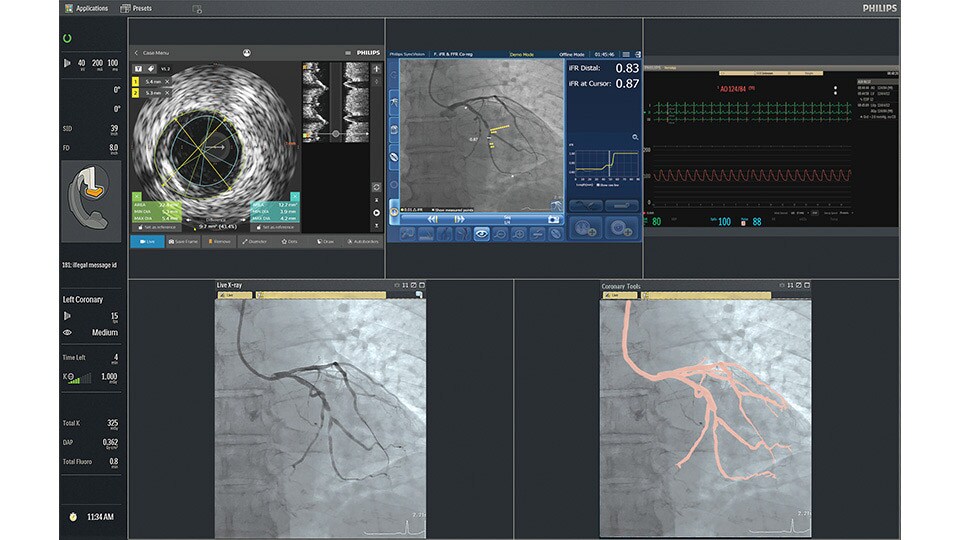 Intrasight visuals