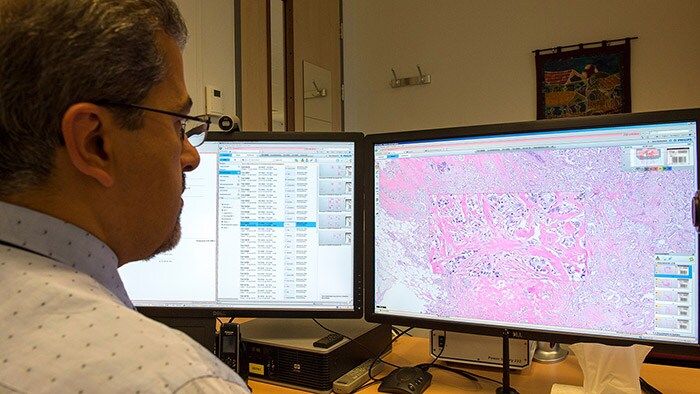 Digital Pathology | Philips | Philips