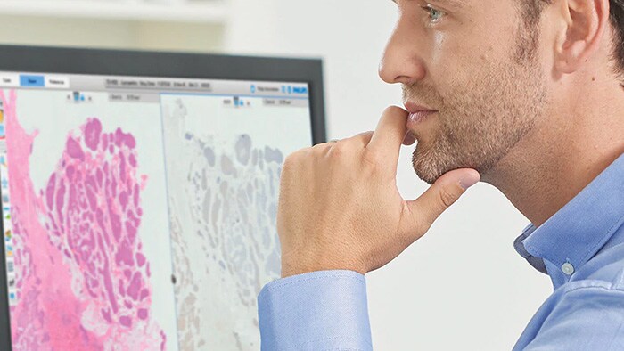 Government and Philips consortium co-invest in digital pathology and AI innovation to improve cancer care in the UK