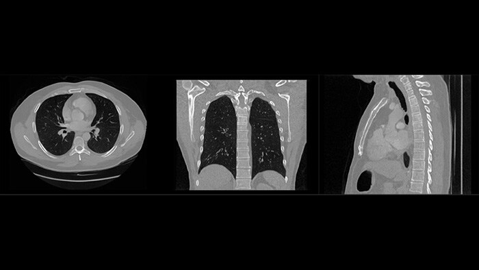 Synthetic medical imaging: accelerating AI in healthcare while protecting privacy